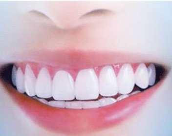 牙齒清潔 牙齒清潔