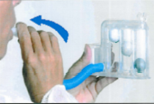 呼吸訓(xùn)練儀用圖4